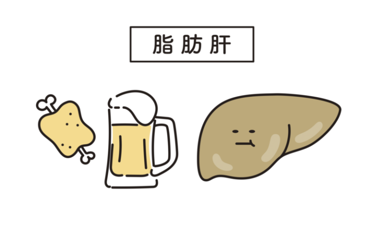 脂肪肝とは